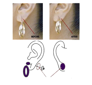 Ear lobe support for earrings (60 Patches)